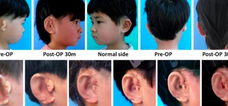 bilim i̇nsanları çocuklar i̇çin üç boyutlu kulak üretti 2